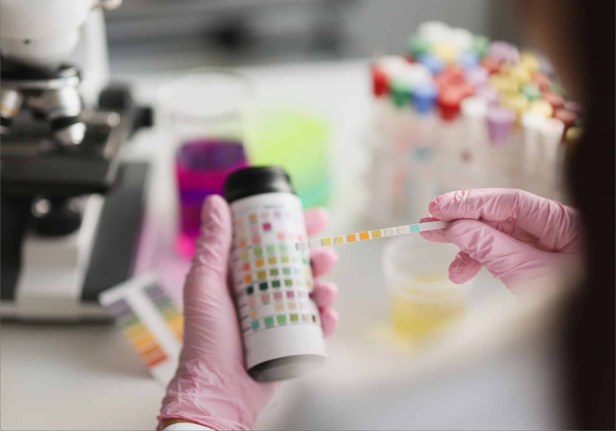 Laboratory technician analyzing a urine test strip for health diagnostics.